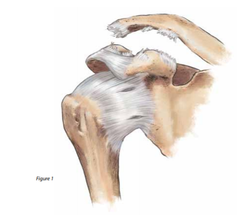 ZipTight Fixation for Ankle Syndesmosis